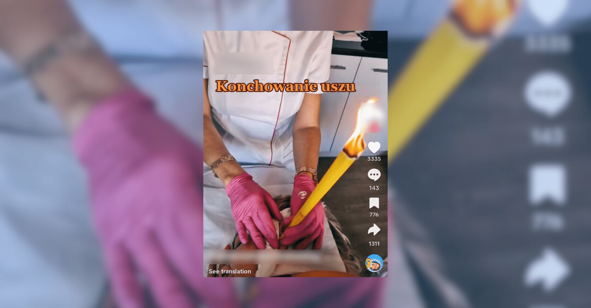 Screenshot tiktoka przedstawiającego niebezpieczną praktykę konchowania (świecowania) uszu